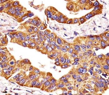 MMP14 Antibody