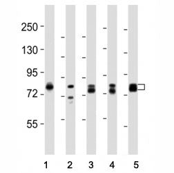 Western blot testing of DNM1L antibody at 1:8000 dilution and lysate from: 1: rat PC12; 2: human ske