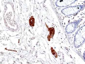 Phosphorylated Tau antibody (pSer396)