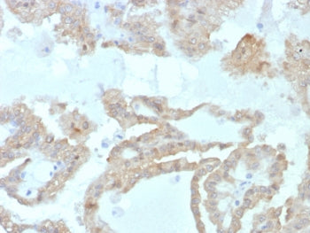 FABP2 Antibody