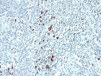 IHC: Formalin-fixed, paraffin-embedded human tonsil stained with Kappa Light Chain antibody (clone T