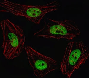 Fluorescent image of HeLa cell stained with PITX2 antibody. Alexa Fluor 488 conjugated secondary (gr