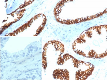 CTNNB1 Antibody / Beta Catenin