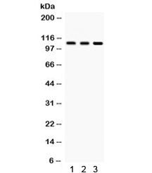 Western blot testing of 1) rat testis, 2) rat brain and 3) human HeLa lysate with CYLD antibody. Pre