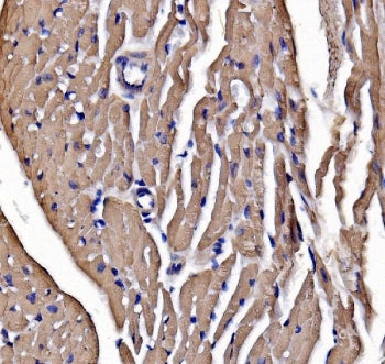 Myosin Heavy Chain 3 Antibody / Myosin 3 / MYH3
