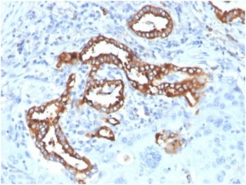 IHC staining of FFPE human lung tissue with recombinant Surfactant Protein D antibody (clone SFTPD/7