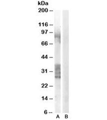 Western blot testing of human prostate lysate with ADAM33 antibody at 0.3ug/ml with [B] and without 