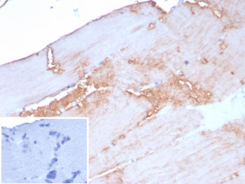 ACTN2 Antibody / Alpha Actinin 2 / Sarcomeric Alpha Actinin