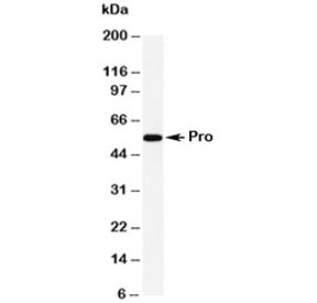 Western blot testing of Caspase-8 antibody and human HeLa cell lysate. Predicted molecular weight: ~
