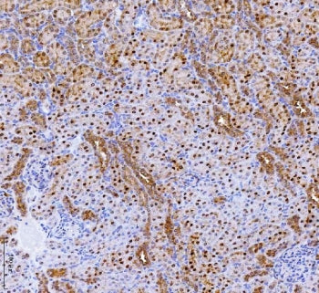 IHC staining of FFPE rat kidney tissue with Batf2 antibody. HIER: boil tissue sections in pH8 EDTA f