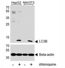 LC3B Antibody (MAP1LC3B)