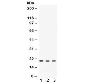 Western blot testing of 1) rat spleen, 2) mouse eye and 3) human SMMC-7721 lysate with Alpha A Cryst