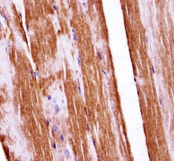 IHC testing of FFPE mouse skeletal muscle tissue with c-Raf antibody. HIER: steam section in pH6 cit