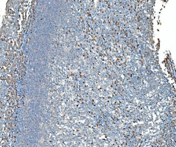 SND1 Antibody / TDRD11