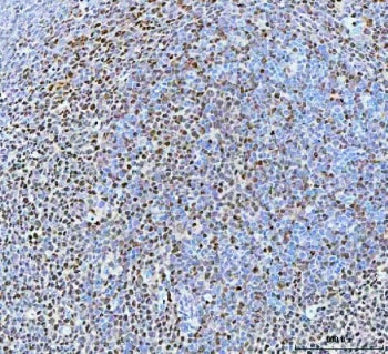 BCL11B Antibody / CTIP2