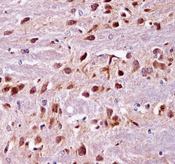 IHC testing of FFPE mouse brain tissue with PRKCA antibody. HIER: steam section in pH6 citrate buffe
