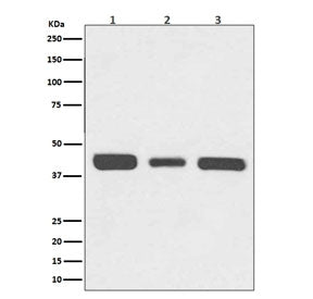 RPSA Antibody / 40S Ribosomal protein SA