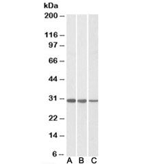 CAPZB Antibody (beta 2)