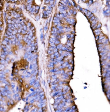 HTR1B Antibody / 5HT1B