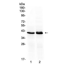 OTC Antibody (Ornithine carbamoyltransferase)