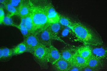 Beta-2 Microglobulin Antibody