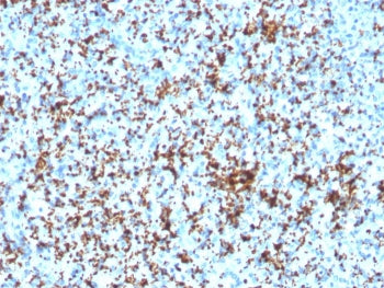 IHC testing of FFPE human spleen with recombinant CD61 antibody (ITGB3/3126R). Required HIER: boil t