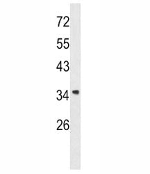 Annexin A1 Antibody