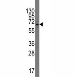 PARP3 Antibody