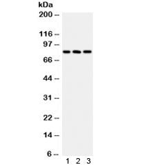 Western blot testing of human 1) HeLa, 2) A549 and 3) COLO320 lysate with Calcineurin A antibody. Predicted molecular weight ~61 kDa, observed here at ~84 kDa.
