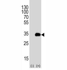 Western blot analysis of ATG-5 antibody and 293T cell lysate either nontransfected (Lane 1) or transiently transfected (2) with the human gene. Predicted molecular weight ATG5: ~32 kDa; ATG5/ATG12 heterodimer: ~56 kDa.