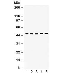 Western blot testing of 1) human placenta, 2) rat kidney, 3) rat liver, 4) rat pancreas and 5) human