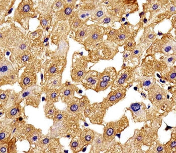 Hemoglobin subunit gamma-2 Antibody / HBG2