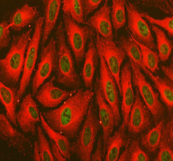 Immunofluorescent staining of FFPE human U-2 OS cells with TORC1 antibody (green) and Alpha Tubulin 