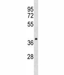 NDRG4 Antibody