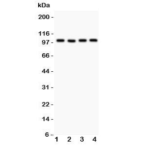 TRPC7 Antibody