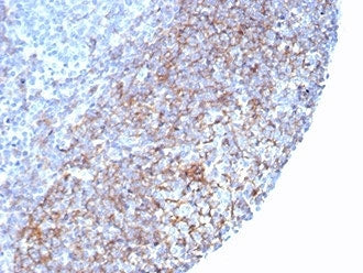 IHC staining of FFPE human tonsil tissue with recombinant CD35 antibody (clone rCR1/7289) at 2ug/ml.