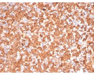 PKC iota Antibody / PRKCI