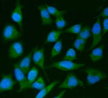 IRS2 Antibody / Insulin receptor substrate 2