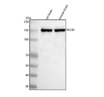 Western blot analysis of PLCB1 using anti-PLCB1 antibody. Lane 1: rat brain tissue lysates, Lane 2: 