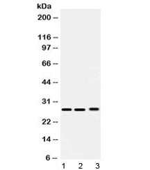 Western blot testing of 1) rat testis, 2) mouse lung and 3) human 293T lysate with PSMA3 antibody at