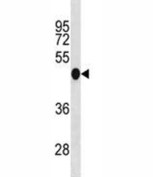 Irf3 Antibody