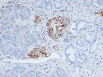 Chromogranin A Antibody