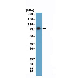 Caldesmon Antibody / CALD1 / CAD