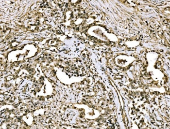 Wings apart-like protein homolog Antibody / WAPL / FOE
