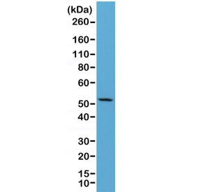 KRT7 Antibody / Cytokeratin 7