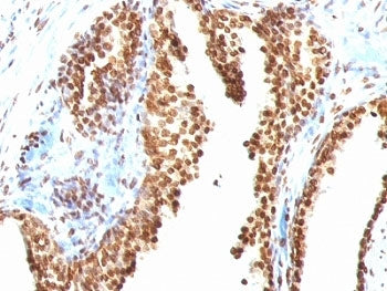 dsDNA Antibody / Double Stranded DNA