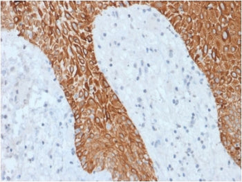 IHC staining of FFPE human skin with recombinant Multi Cytokeratin antibody (clone KRT/1877R). HIER: