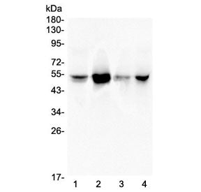 RBBP4 Antibody / RbAp48 / NURF55