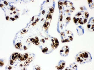 IHC testing of FFPE human placenta with Band 3 antibody. HIER: Boil the paraffin sections in pH 6, 1