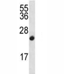 CDKN2B Antibody